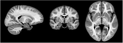 Macromolecular Proton Fraction as a Myelin Biomarker: Principles, Validation, and Applications